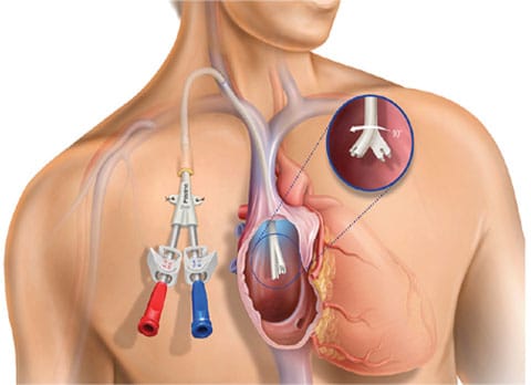 Kidney specialist in Melur